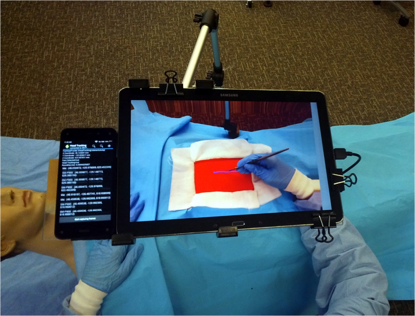 Image for project Augmented Reality Surgical Telementoring