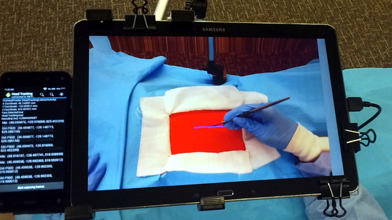 Augmented Reality Surgical Telementoring