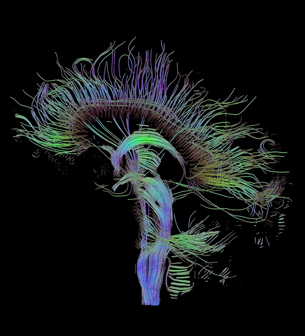 Fiber Tracts in Diffusion Tensor MRI Dataset