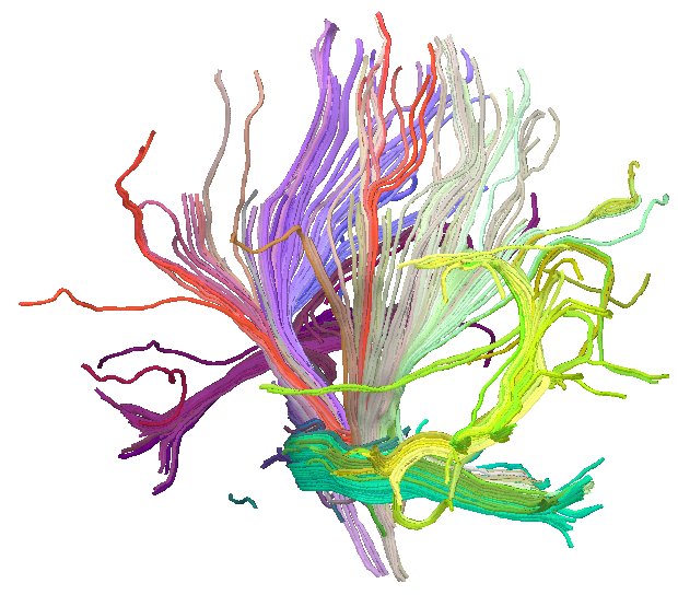 Fiber coloring in Diffusion Tensor MRI